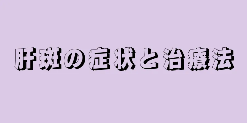 肝斑の症状と治療法