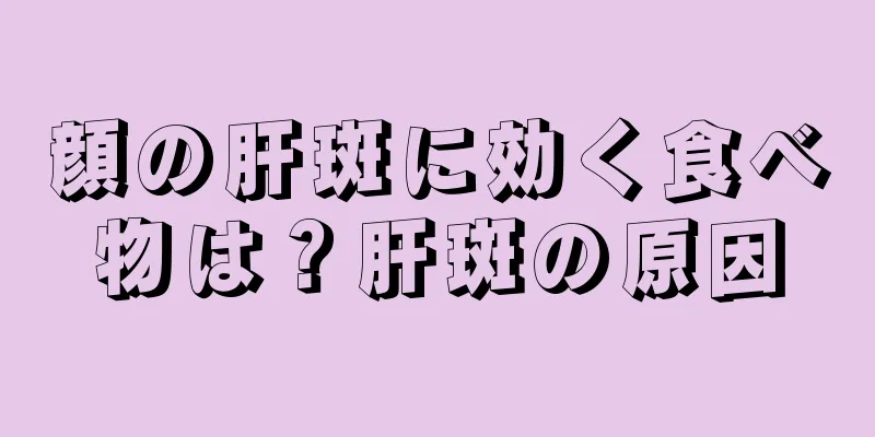 顔の肝斑に効く食べ物は？肝斑の原因