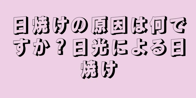 日焼けの原因は何ですか？日光による日焼け