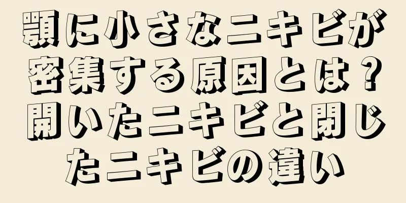 顎に小さなニキビが密集する原因とは？開いたニキビと閉じたニキビの違い