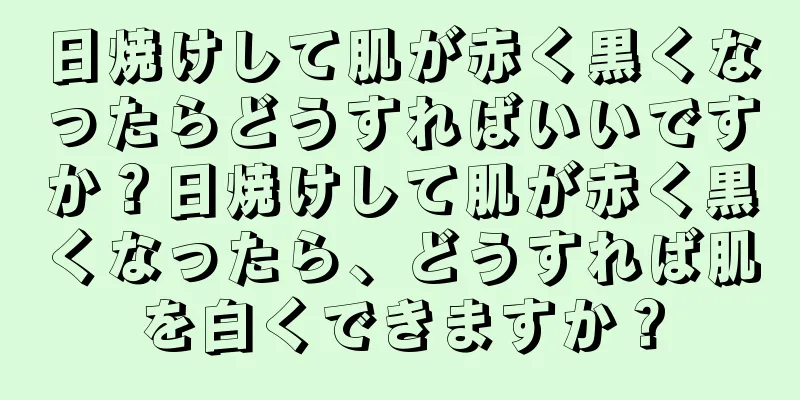 日焼けして肌が赤く黒くなったらどうすればいいですか？日焼けして肌が赤く黒くなったら、どうすれば肌を白くできますか？