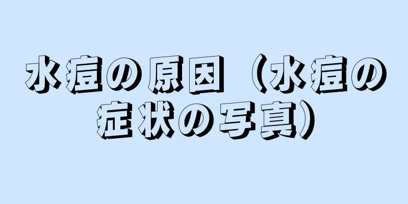 水痘の原因（水痘の症状の写真）