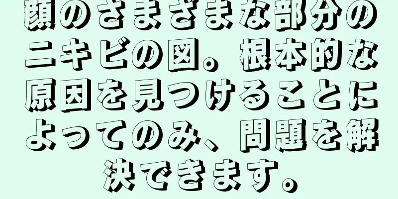 顔のさまざまな部分のニキビの図。根本的な原因を見つけることによってのみ、問題を解決できます。